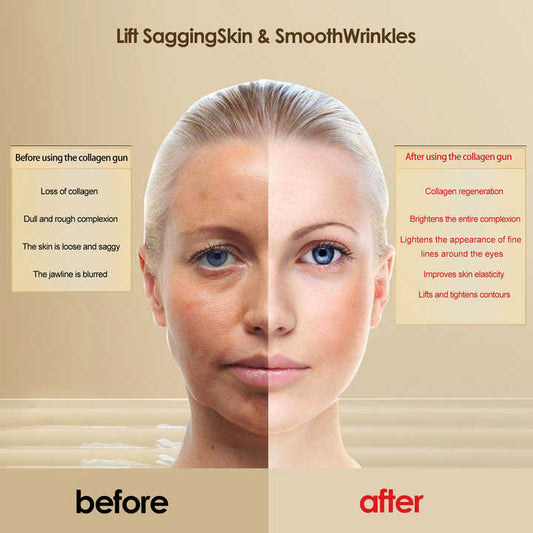 جهاز تجميلي لشد البشره - اطقم العنايه