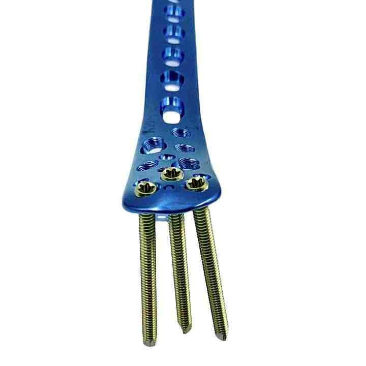 Medical Device Lock Screw