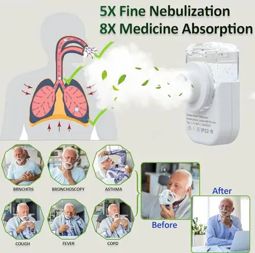 Portable mesh nebulizers