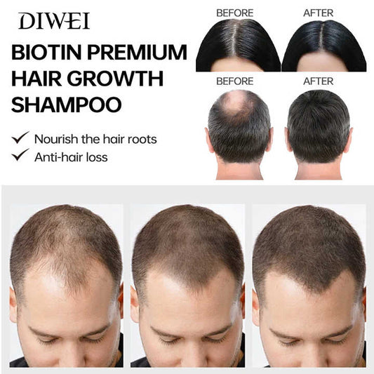 DIWEI Onion Biotin Shampoo-Shampoo and Conditioner Set