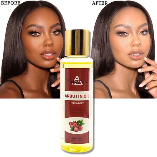 أربوتين طبيعي لتبييض البشرة - اطقم العنايه