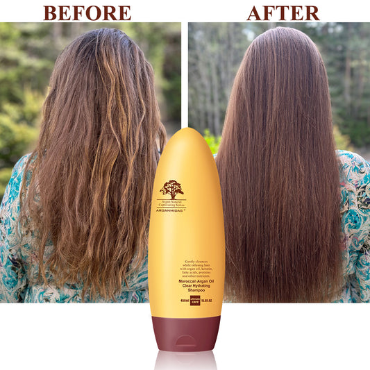 العناية بالشعر