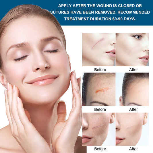 Professional Burn Skin Facial Plastic Surgery Scar Repair