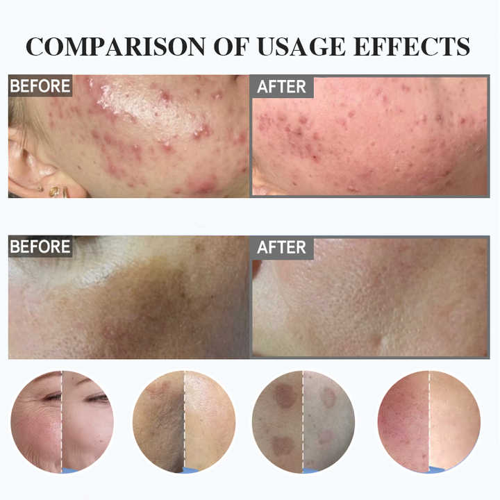 Exfoliating Spongilla-منتج تقشير البشرة