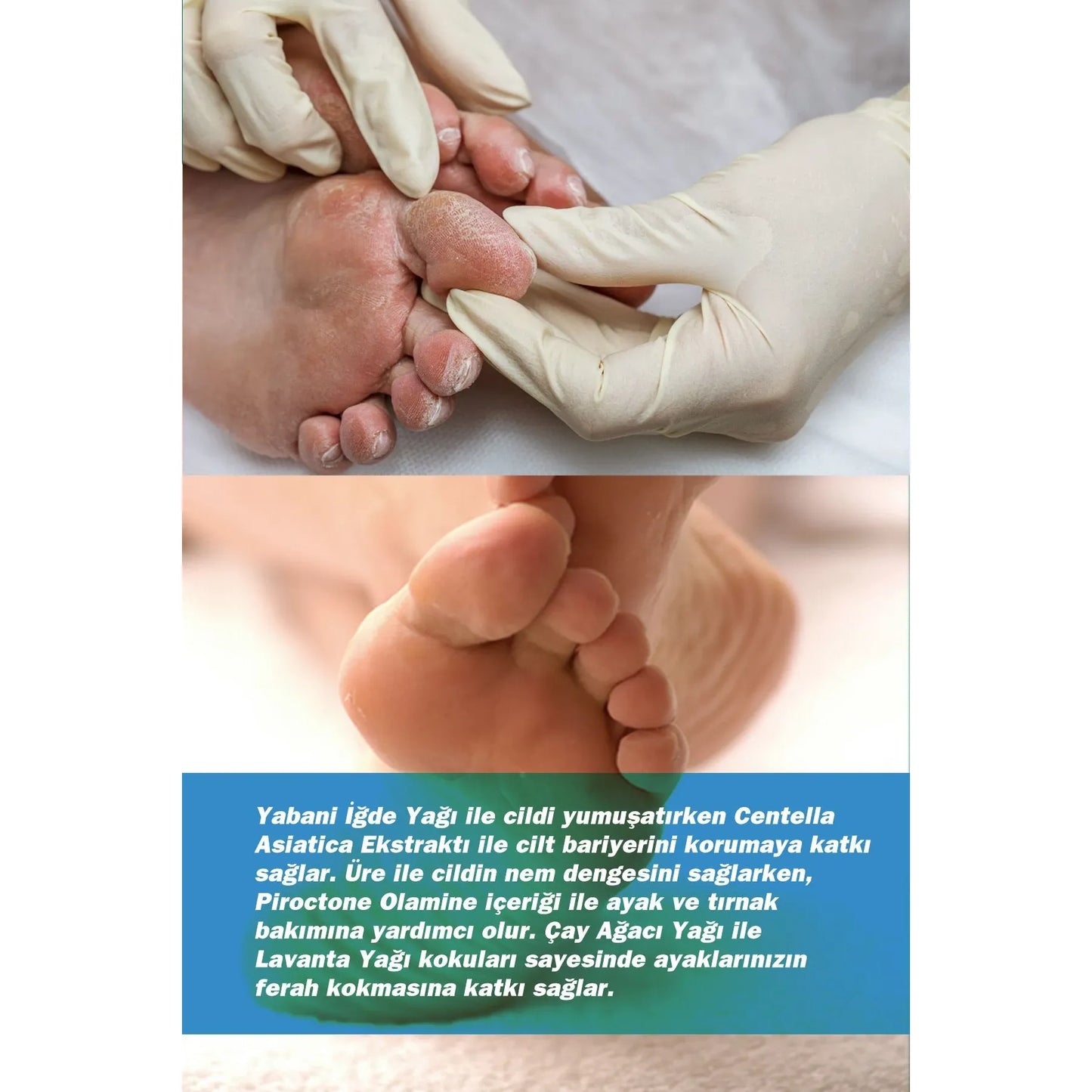 العناية بالقدمين