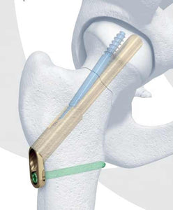 Screw for medical equipment set 