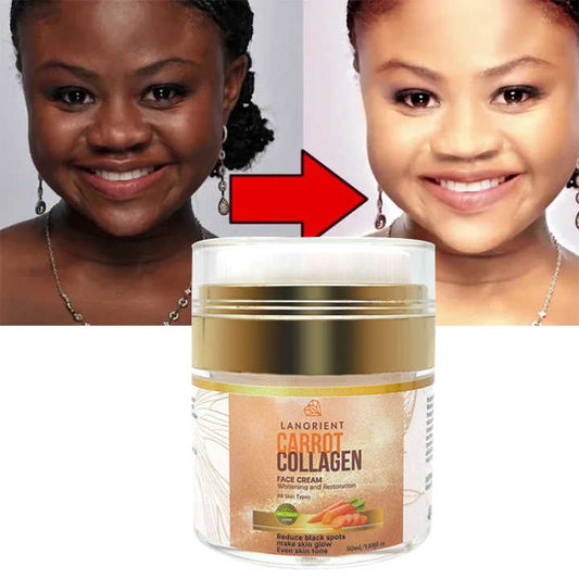 Whitening Skin Face Cream for All Skin Typesمنتجات العناية بالبشرة -  LANORIENT كوريا ذات