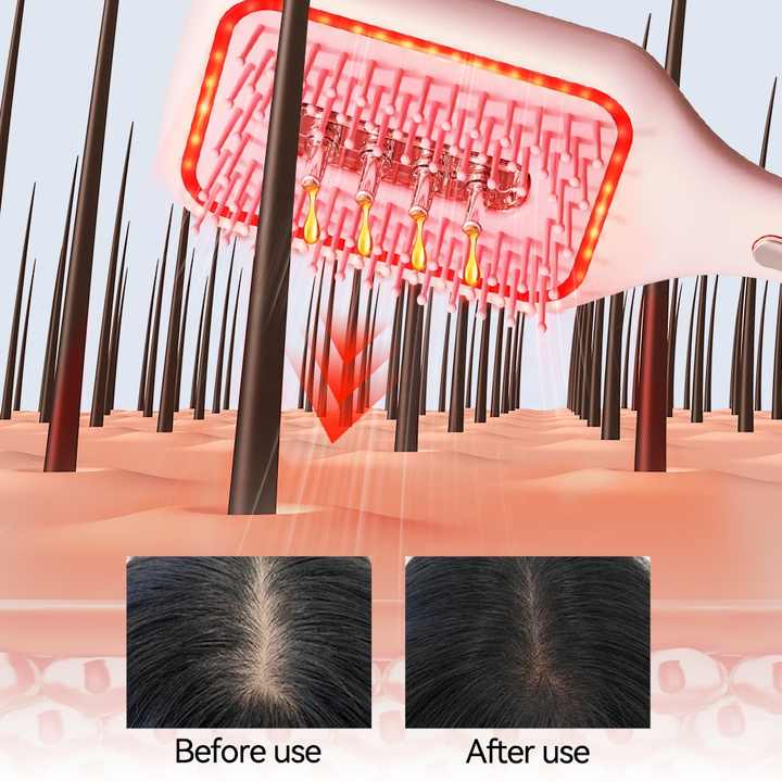 Therapy air Cushion Hair Growth Combفرشاة تدليك فروة الرأس -  Airbag EMS لنمو الشعر
