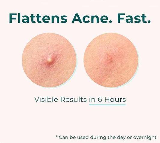 Private Label Box Skin Care Easy 