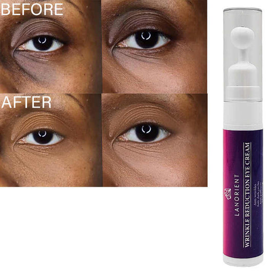 Removal Eye Bag Retinol Eye Cream With Ball Massager منتجات العناية بالبشرة من كوريا