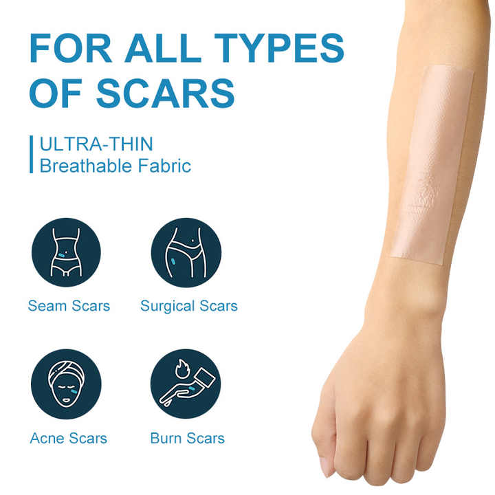 Silicone strip for removing acne scars, 