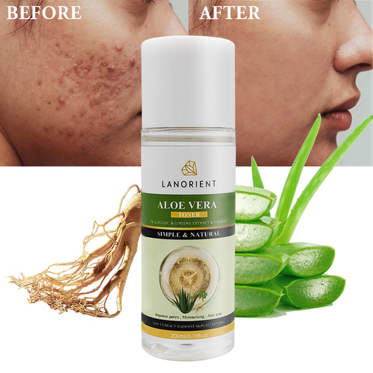 Facial Skin Damage Aloe Vera Anti-Acne Toner for Face - منتجات العناية بالبشرة من كوريا
