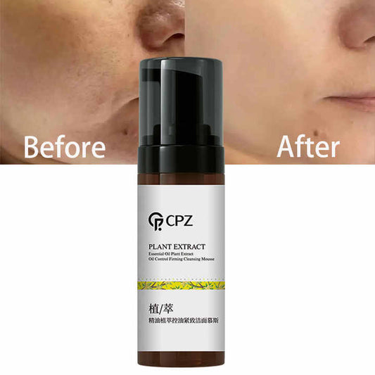 CPZ Moisturizer-مرطب للعناية