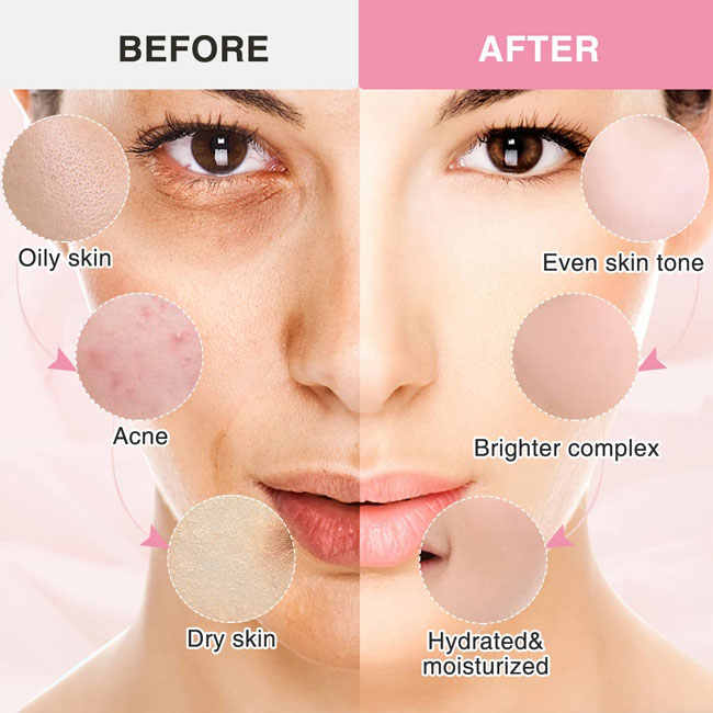 Dark Spot Moisturizer Face Cream 