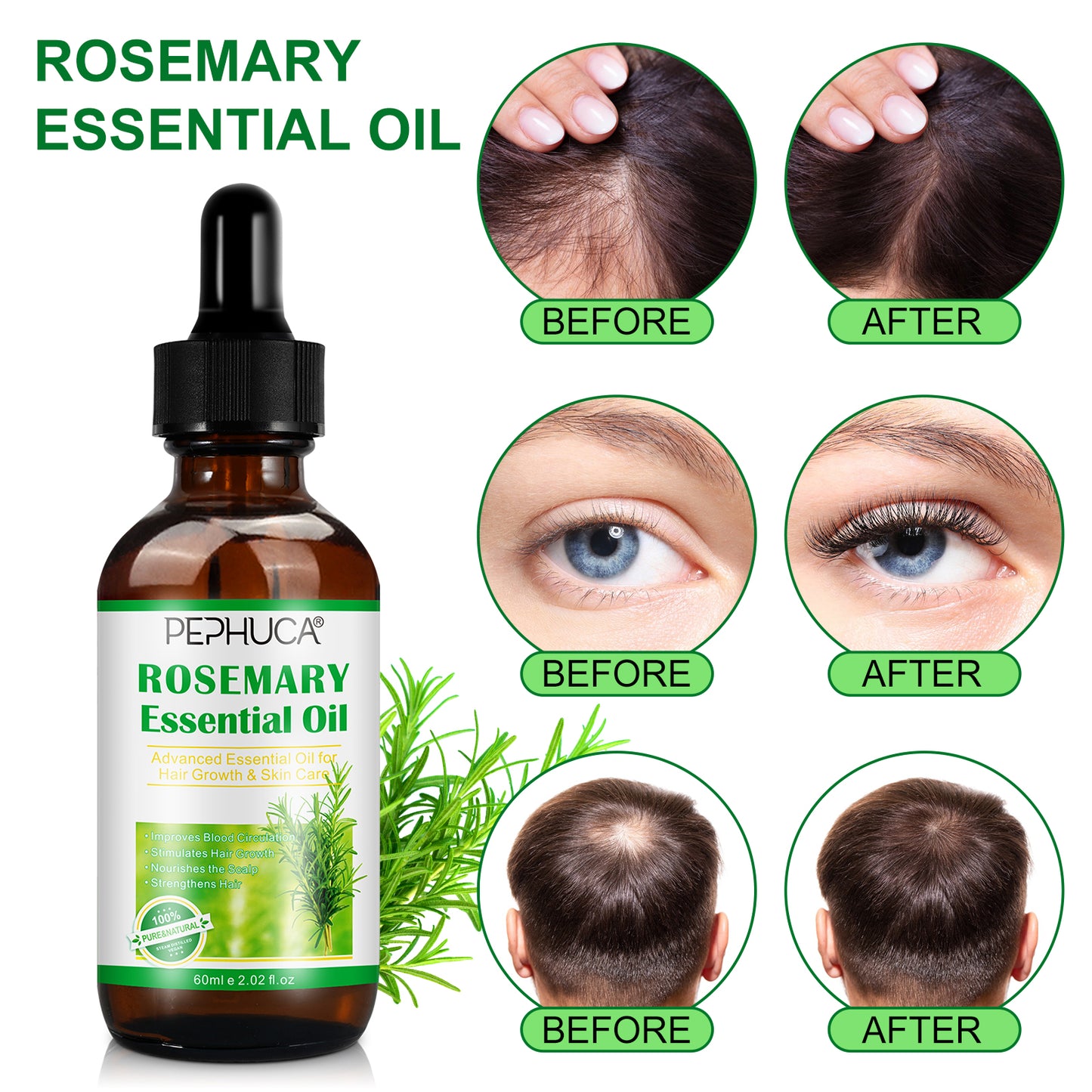 العناية بالشعر