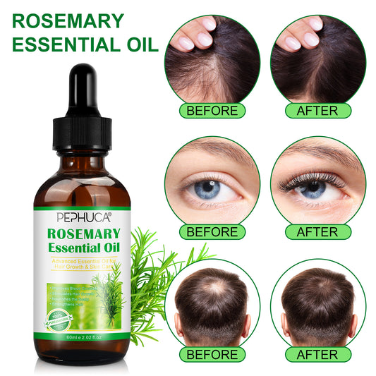 العناية بالشعر