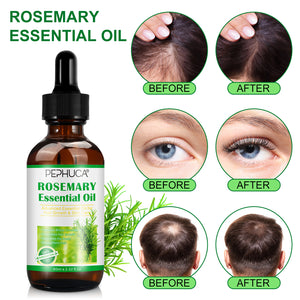 العناية بالشعر