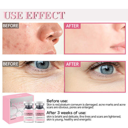 Hot Sale Exo Anti-wrinkle Repair 