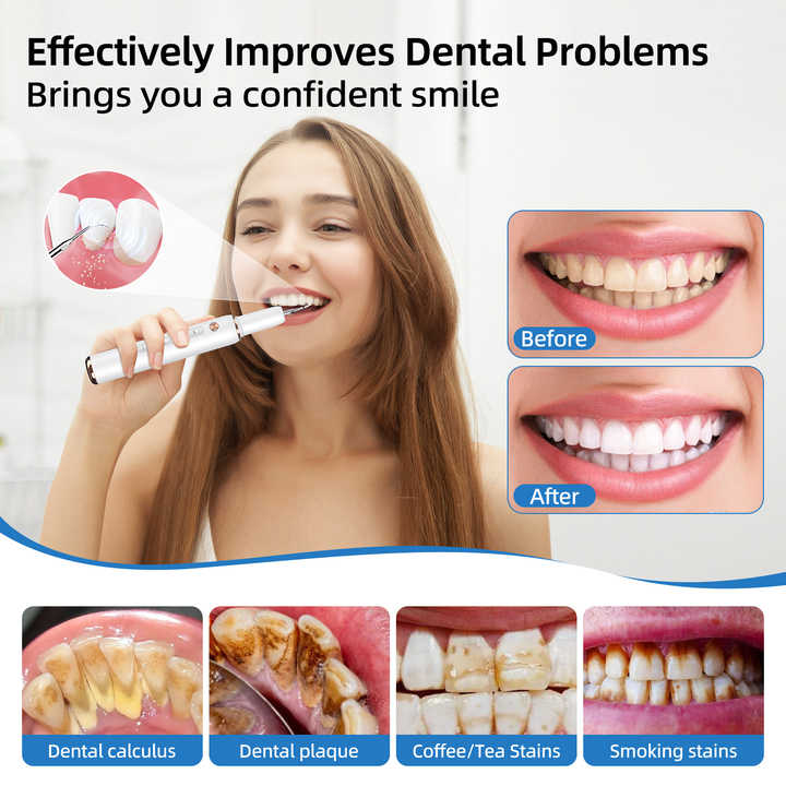 Dental cleaning device 