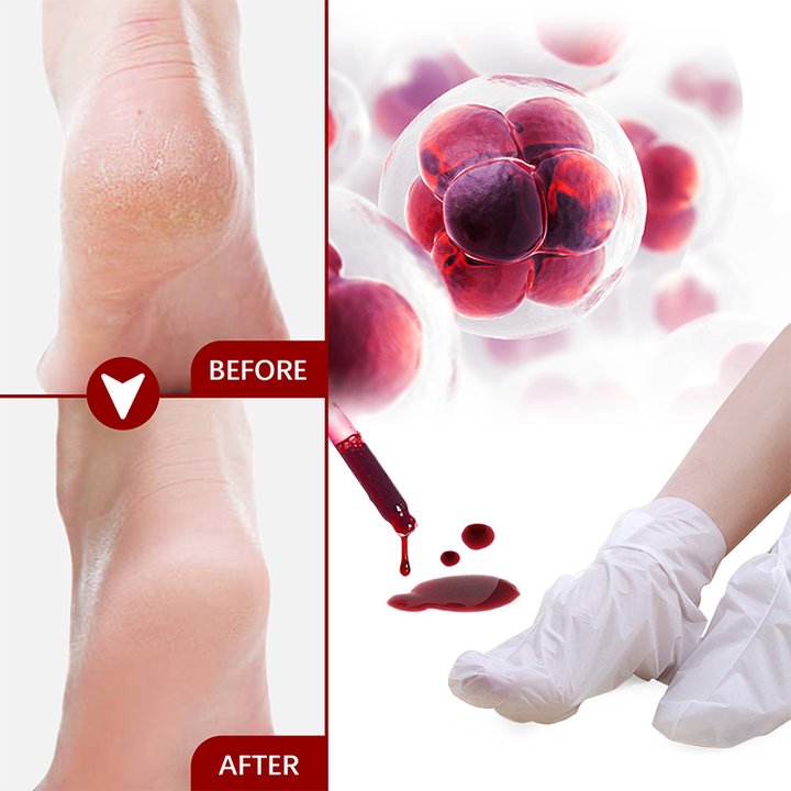Remove Dead Skin and Calluses Exfoliating Peeling Foot Mask 