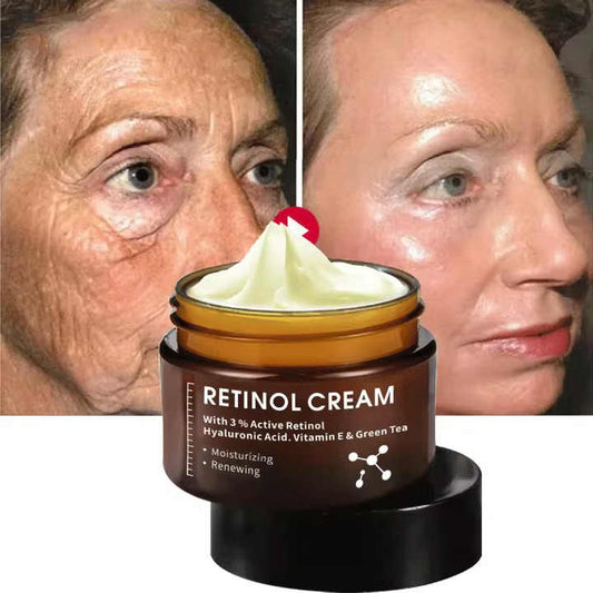 Whitening Moisturizing 3% Retinol Face Cream Private Label Organic Face Cream with Vitamin E, Anti-Wrinkle, Whitening 