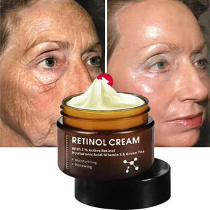 Whitening Moisturizing 3% Retinol Face Cream Private Label Organic Face Cream with Vitamin E, Anti-Wrinkle, Whitening 