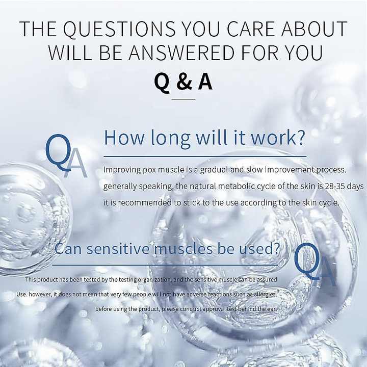 Removes Spots and Acne Main Ingredient Emu Oil Beauty Product Best Anti-Acne Cream with Modern Design for Facial Treatment 