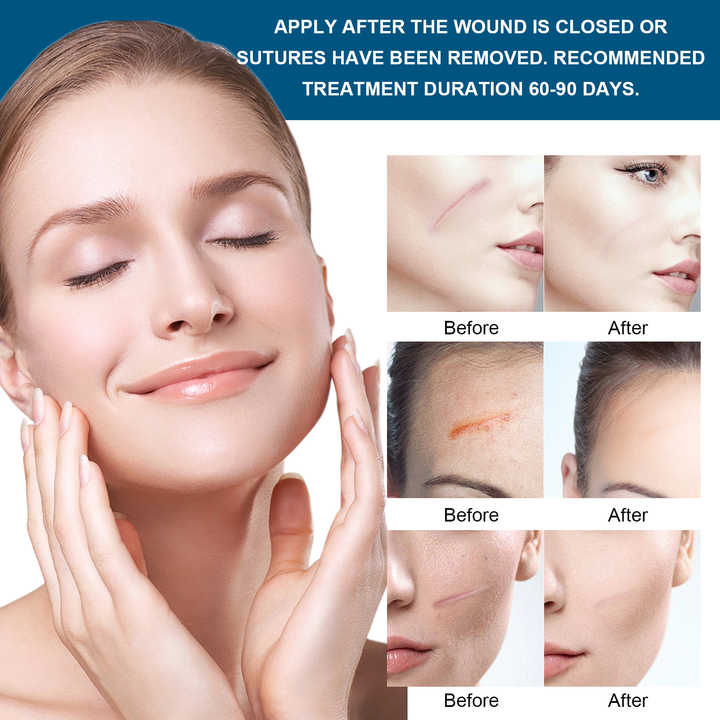 Professional Burn Skin Facial Plastic Surgery Scar Repair 