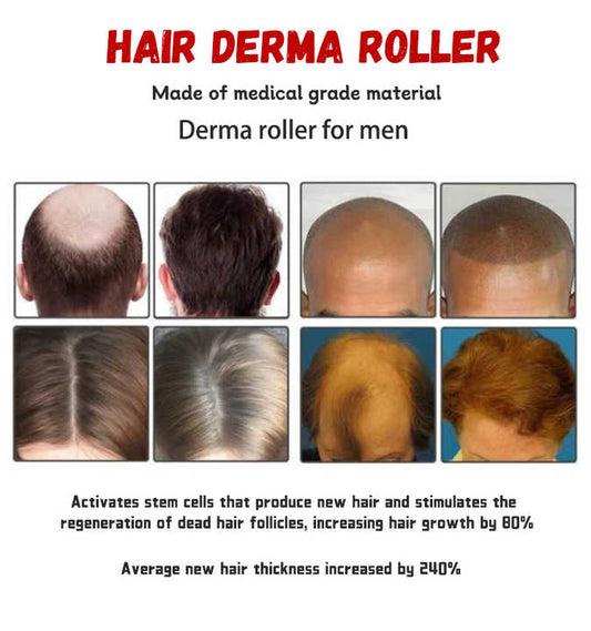 Derma Roller for Hair Regrowth Beard Skin Face - Best Selling Derma Roller Model 