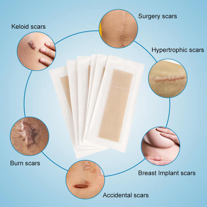 Silicone strip for removing acne scars, 