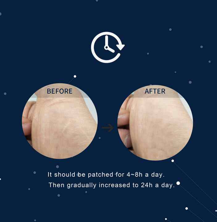 Silicone strip for removing acne scars, 