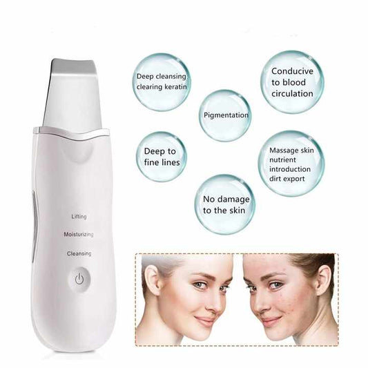Electric Dead Skin Scrubber Peeling-جهاز تقشير كهربائي