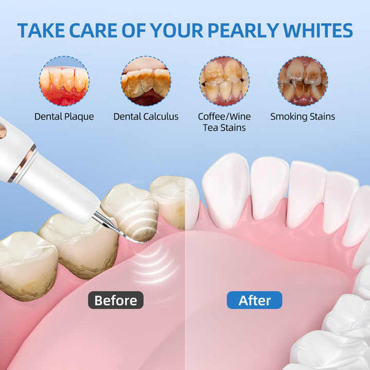 Dental cleaning device 