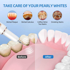 Dental cleaning device 