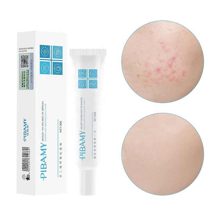 Removes Spots and Acne Main Ingredient Emu Oil Beauty Product Best Anti-Acne Cream with Modern Design for Facial Treatment 