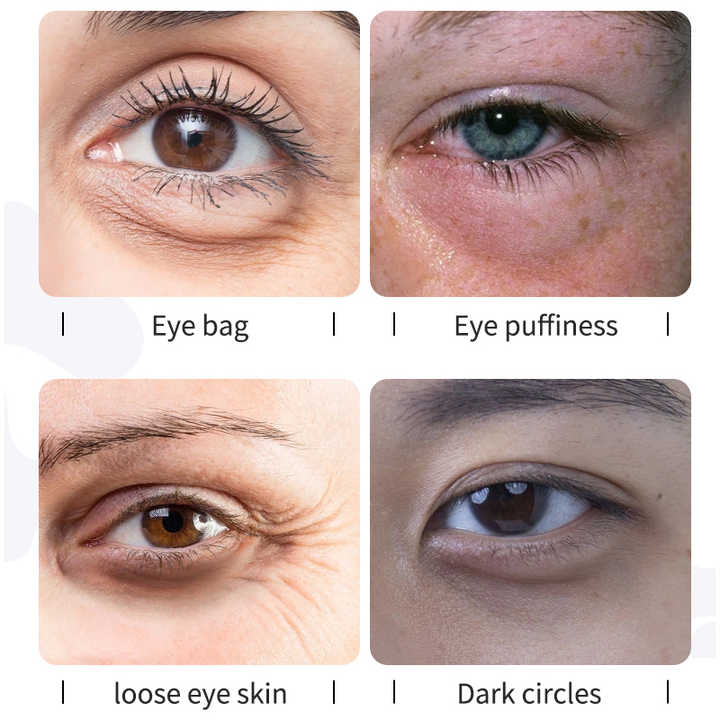 eye cream