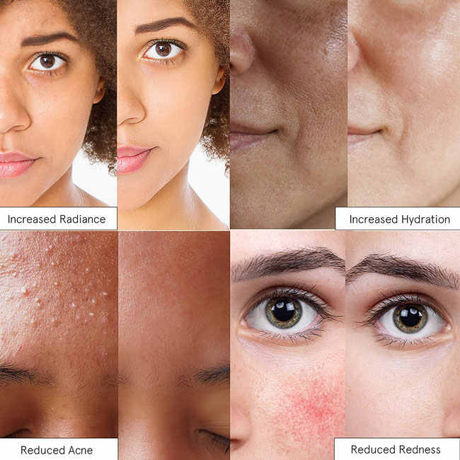 Dark Spot Moisturizer Face Cream 