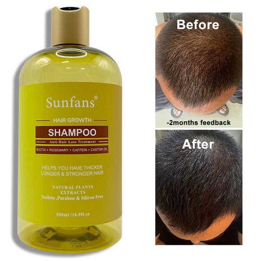 شامبو نمو الشعر -العنايه بالشعر