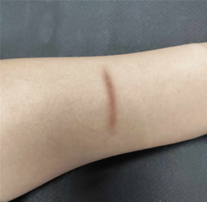 اسعافات اوليه ورقة وسادات جل سيليكون طبية للندوب الجدرة