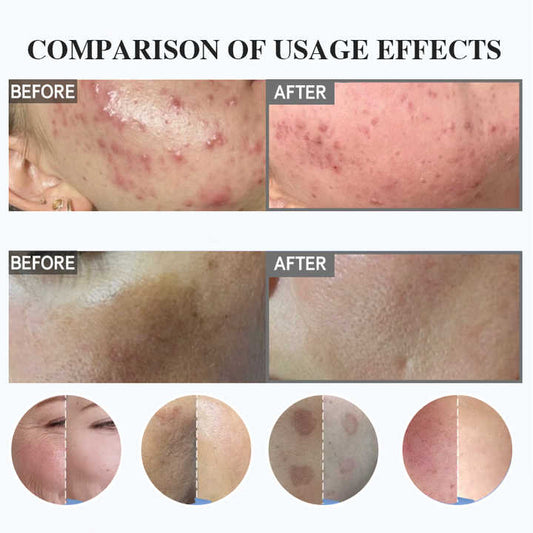 Exfoliating Spongilla-منتج تقشير البشرة