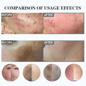 Exfoliating Spongilla-منتج تقشير البشرة