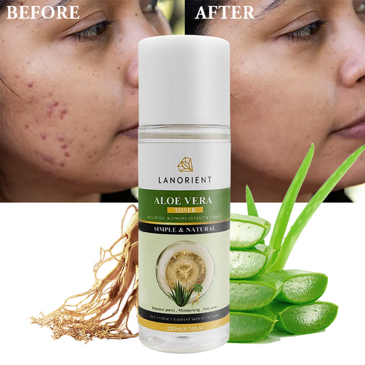 Facial Skin Damage Aloe Vera Anti-Acne Toner for Face - Skin Care Products from Korea