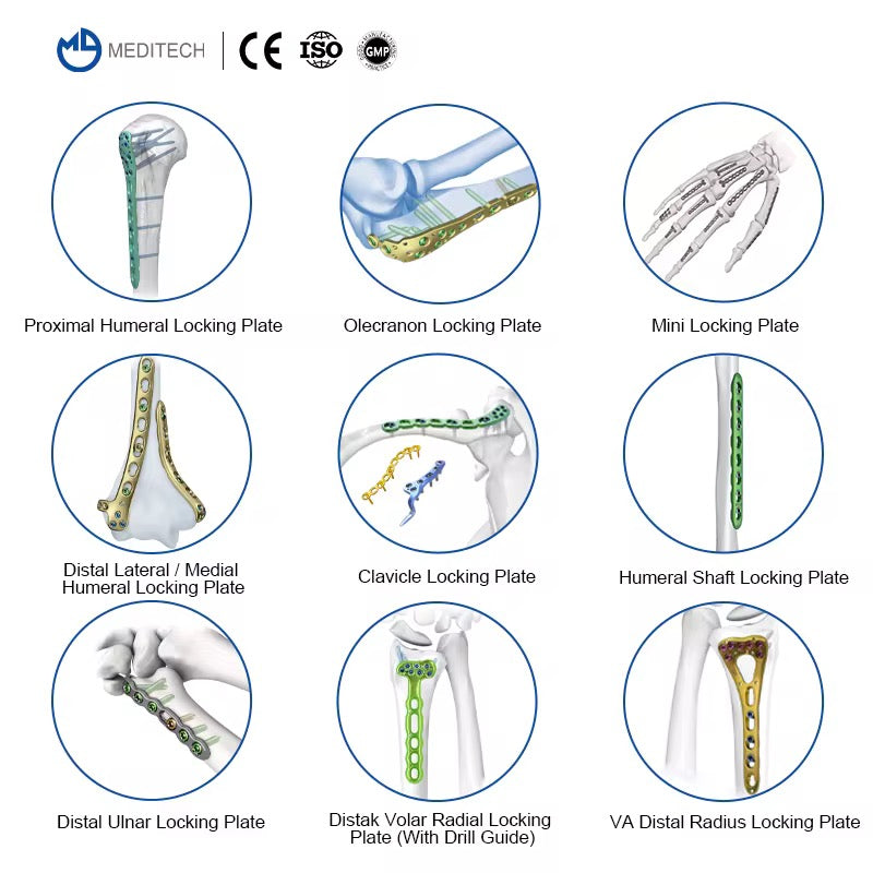 Medical devices for bone fragments