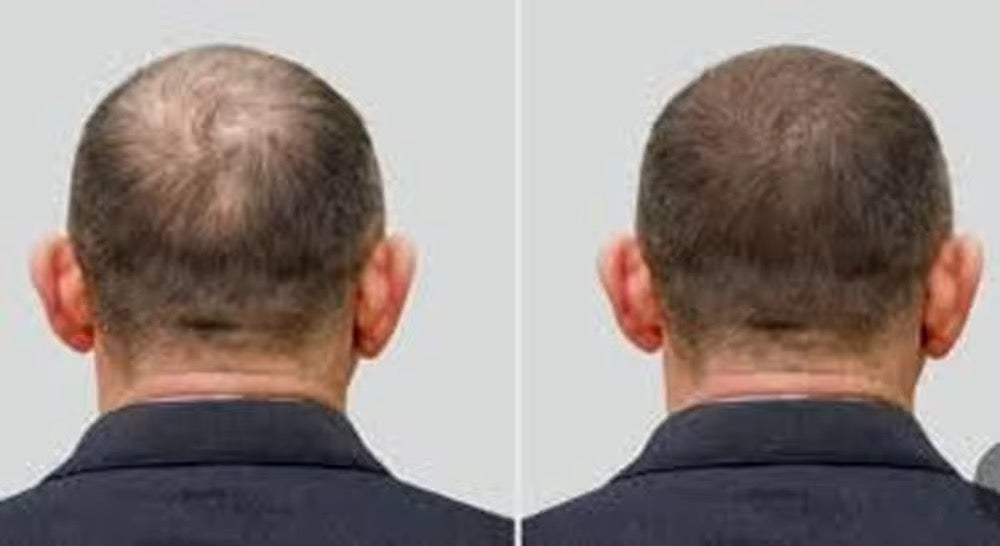 مستلزمات الشعر Hair Supplies