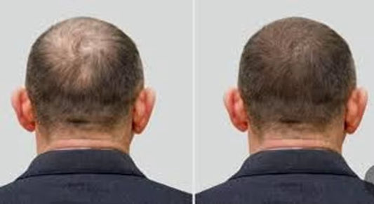 مستلزمات الشعر Hair Supplies