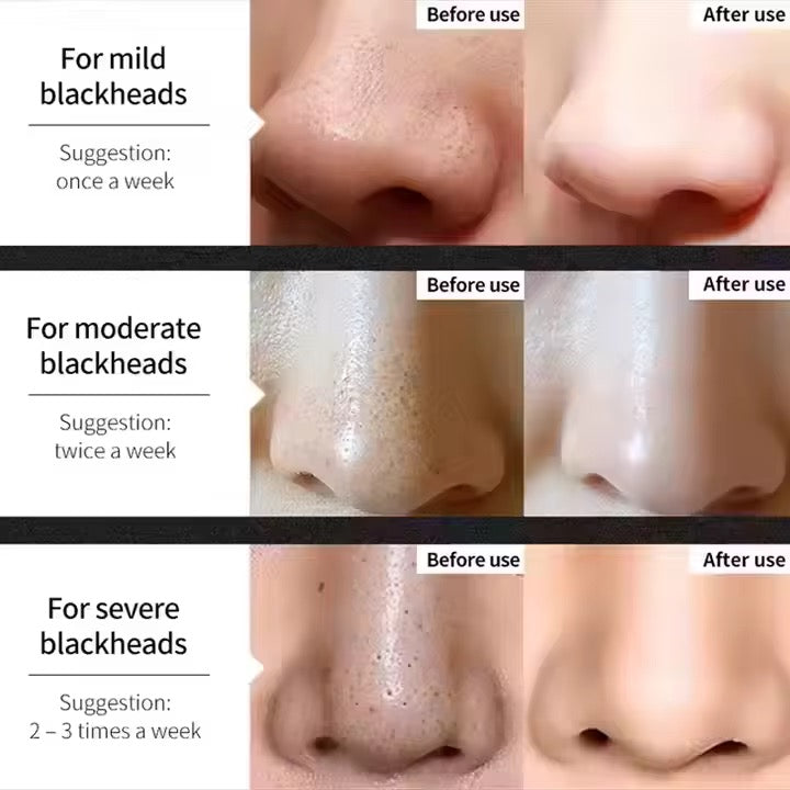 face mask