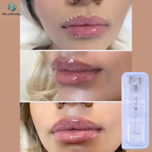 حشو خاص بجلد البشرة للشفاه - العنايه بالشفايف